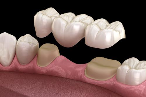Rekonstruktive Zahnmedizin 